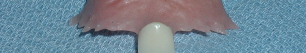 Dental Flippers in Palm Harbor Office