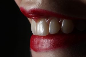 Natural Ways to Remove Tartar and Gingivitis Treatment