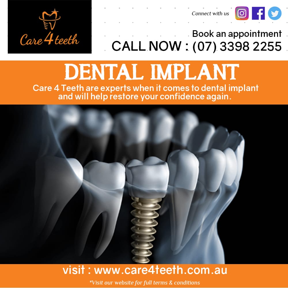Care 4 Teeth – Dental Implant Carina Brisbane