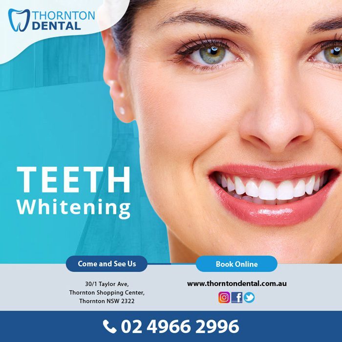 Teeth Whitening Thornton | Maitland – Thornton Dental