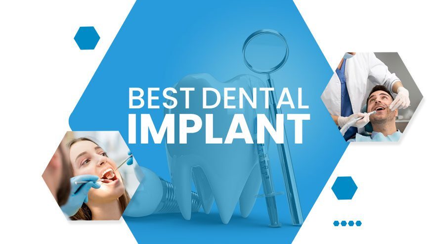 Discover Excellence at the Best Dental Hospital in Mohali